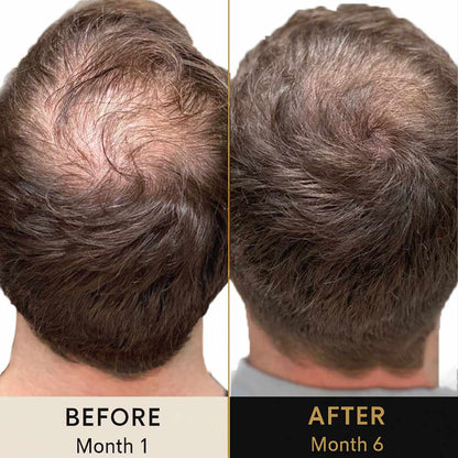 Bold Inkline™ – Hair Preservation Formula