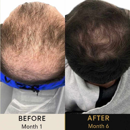 Bold Inkline™ – Hair Preservation Formula